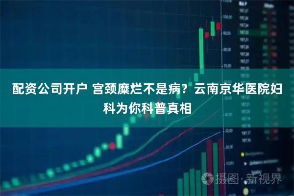 配资公司开户 宫颈糜烂不是病？云南京华医院妇科为你科普真相